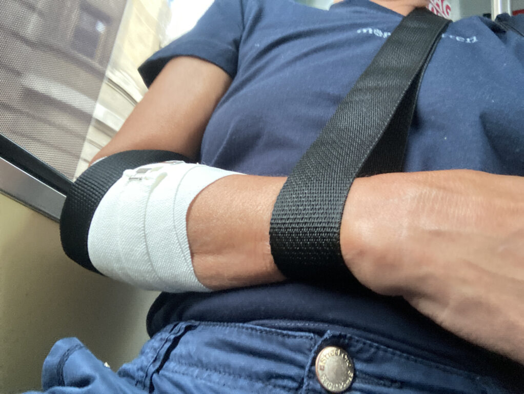 Arm mit Bandage
